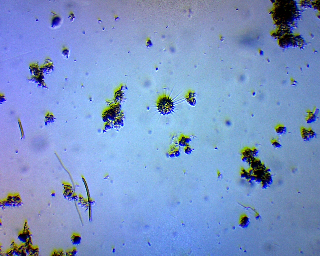 heliozoa